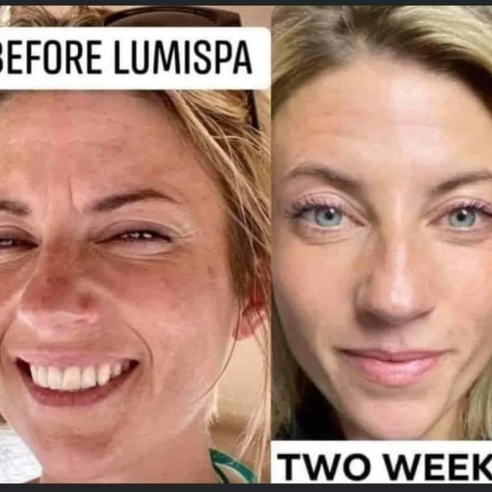 Lumispa - Picture 5 of 6